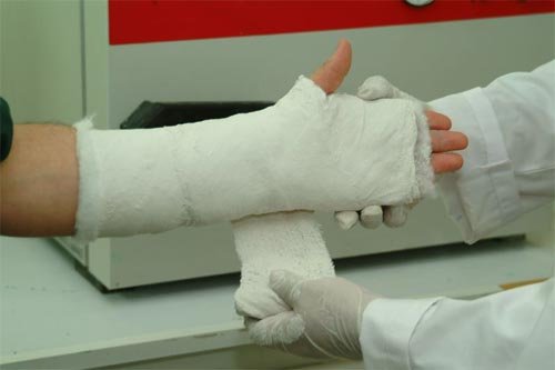 Пациент со сломанной рукой умудрился сломать ногу другому пациенту